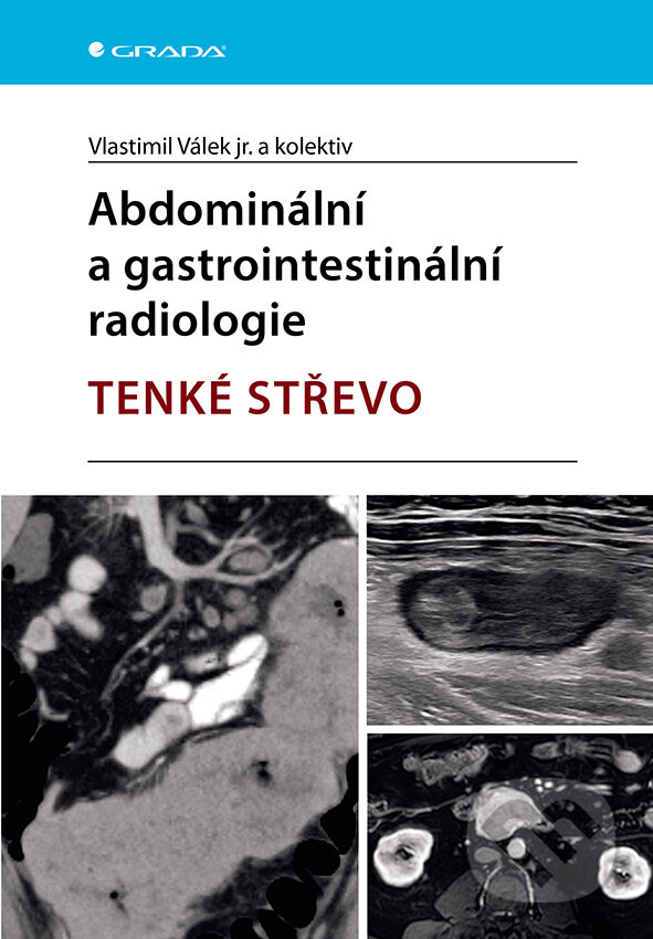 Levně Abdominální a gastrointestinální radiologie (Tenké střevo) - kniha z kategorie Vysoké školy