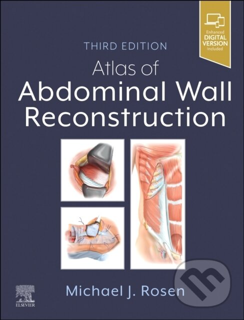 Levně Atlas of Abdominal Wall Reconstruction - Michael J. - kniha z kategorie Chirurgia