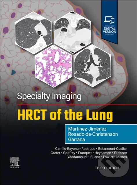 Levně Specialty Imaging: HRCT of the Lung - FAAWR Rosado-de-Christenson - kniha z kategorie Onkológia