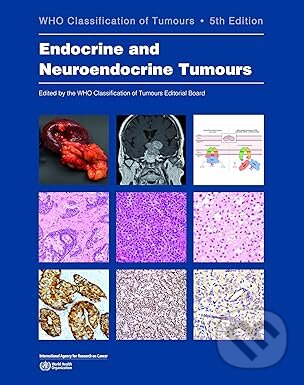 Levně WHO Classification of Endocrine and Neuroendocrine Tumours - kniha z kategorie Onkológia