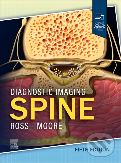 Levně Diagnostic Imaging: Spine (Fifth Edition) - Jeffrey S. Ross, Kevin R. Moore - kniha z kategorie Vysoké školy