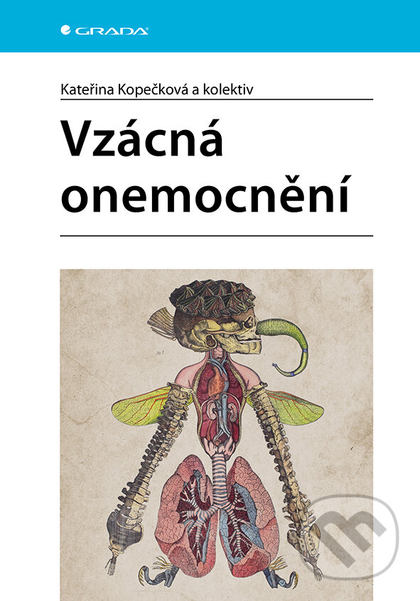 Levně Vzácná onemocnění - Kateřina Kopečková - kniha z kategorie Medicína