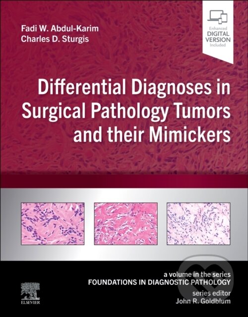 Differential Diagnoses in Surgical Pathology Tumors and their Mimickers, A Volume in the Foundations in Diagnostic Pathology series Elsevier