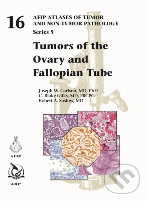 Levně Tumors of the Ovary and Fallopian Tube - C. Blake Gilks, Joseph W. Carlson, Robert A. Soslow - kniha z kategorie Onkológia