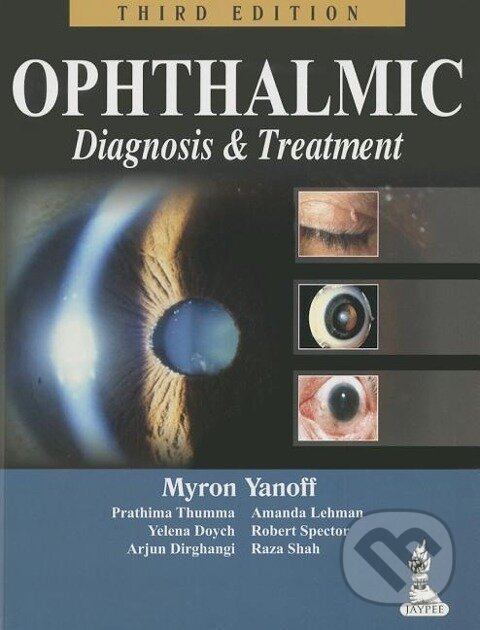 Kniha: Ophthalmic Diagnosis & Treatment (Myron Yanoff). , 2014