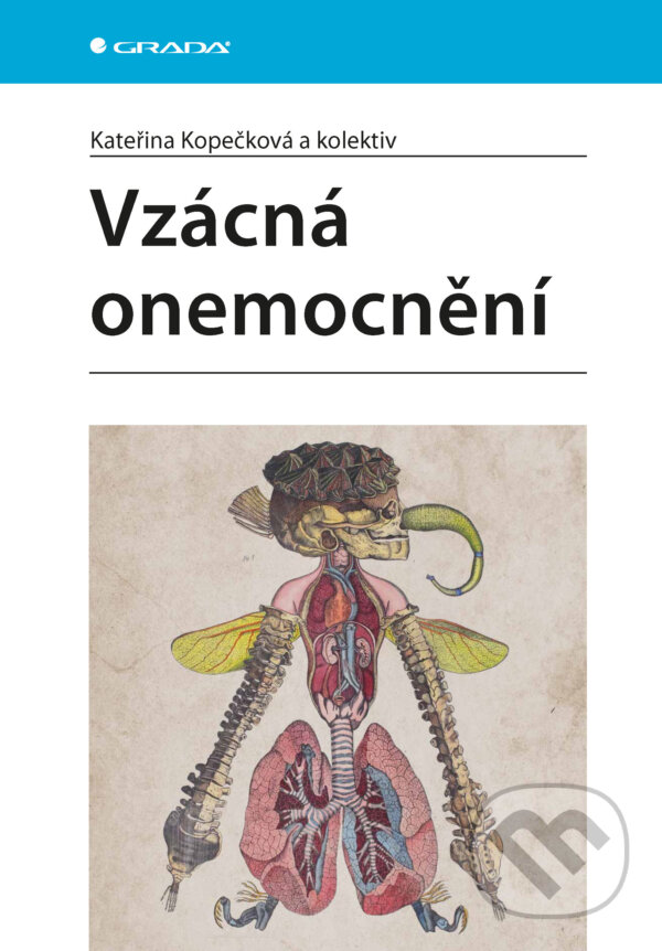 E-kniha: Vzácná onemocnění (Kopečková Kateřina a kolektív). Grada, 2025