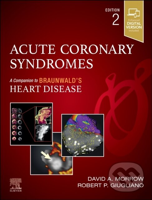 Levně Acute Coronary Syndromes - David A. Morrow, Robert P., MD, ScM Giugliano - kniha z kategorie Kardiológia a Angiológia
