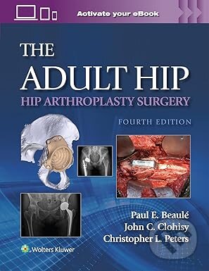 Kniha Adult Hip Hip Arthroplasty Surgery Print