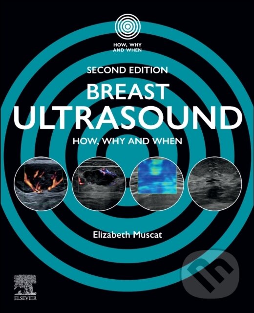 Kniha: Breast Ultrasound, 2nd Edition (Muscat). Elsevier Science, 2026