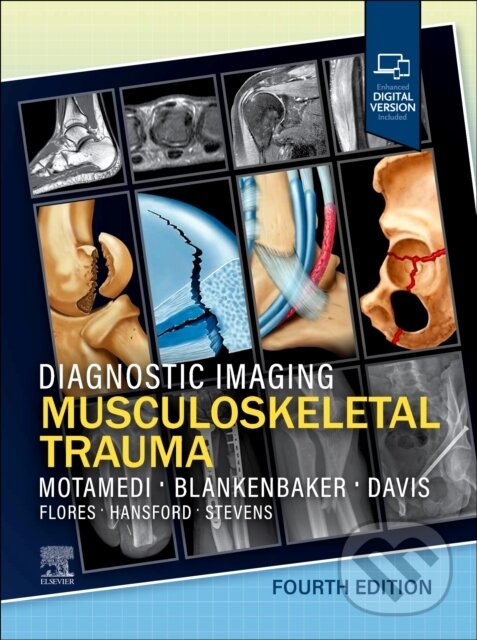 Kniha: Diagnostic Imaging: Musculoskeletal Trauma (Donna G., MD. Blankenbaker, Kirkland W., MD, FACR Davis, Kambiz a FACR Motamedi). Churchill Livingstone, 2026