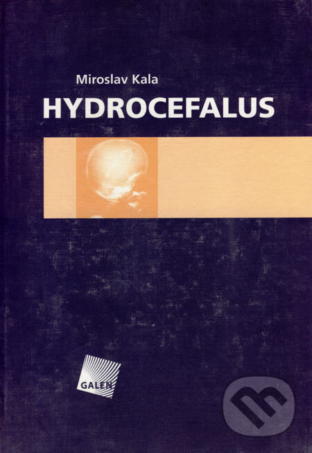 Levně Hydrocefalus - Miroslav Kala - kniha z kategorie Neurochirurgia
