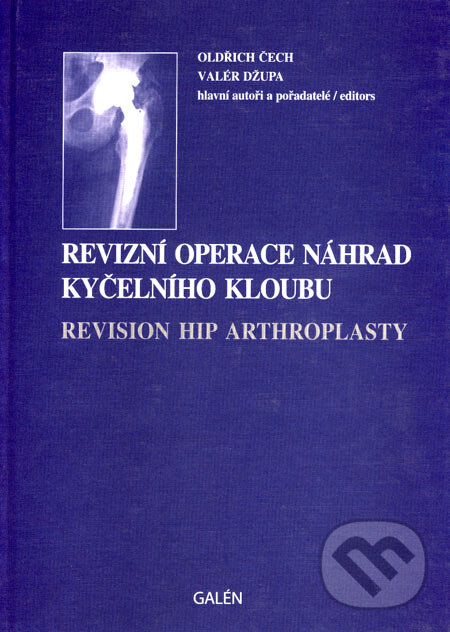 Levně Revizní operace náhrad kyčelního kloubu - Oldřich Čech, Valér Džupa - kniha z kategorie Chirurgia