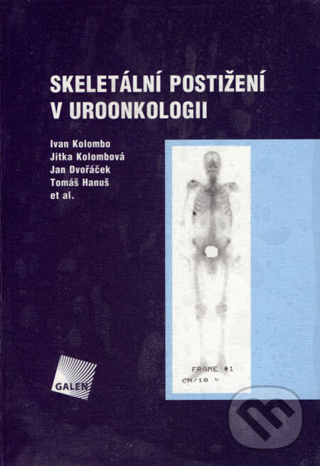 Levně Skeletální postižení v uroonkologii - Ivan Kolombo, Jitka Kolombová, Jan Dvořáček, Tomáš Hanuš - kniha z kategorie Onkológia