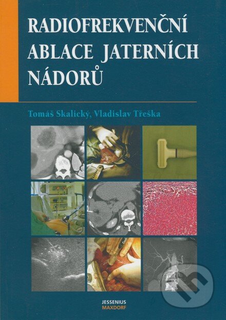 Levně Radiofrekvenční ablace jaterních nádorů - Tomáš Skalický, Vladislav Třeška - kniha z kategorie Onkológia