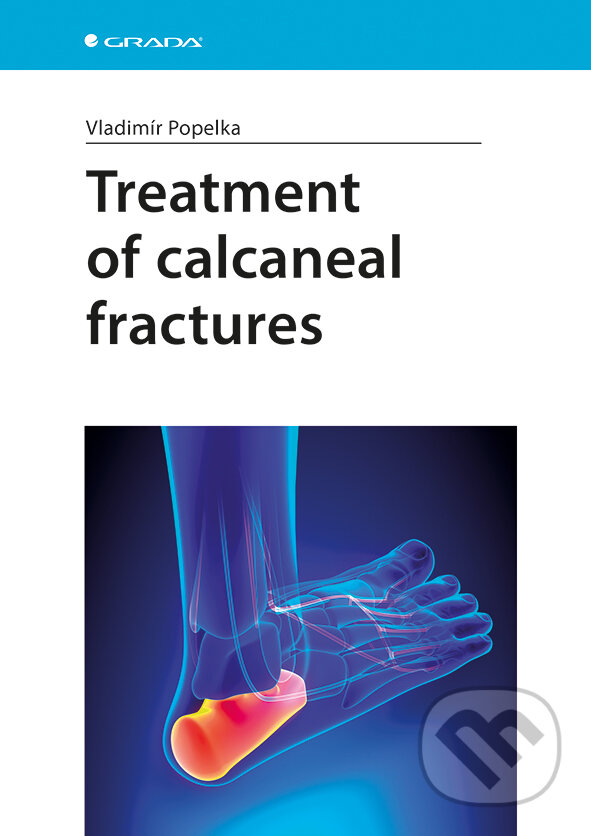 Treatment of calcaneal fractures - Vladimír Popelka, Grada, 2018