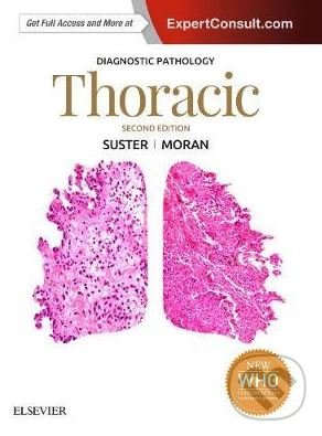 Kniha: Diagnostic Pathology: Thoracic (Cesar A. Moran a Saul Suster). Elsevier Science, 2017