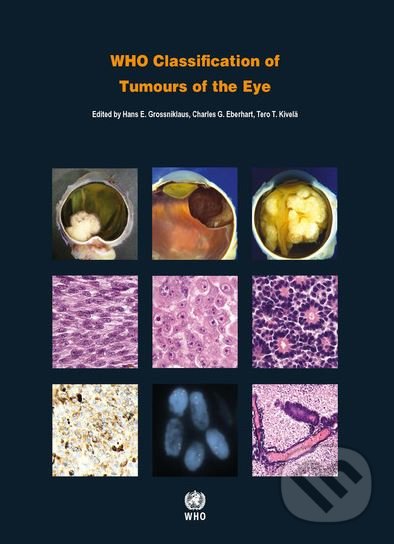 Levně WHO Classification of Tumours of the Eye - kniha z kategorie Medicína