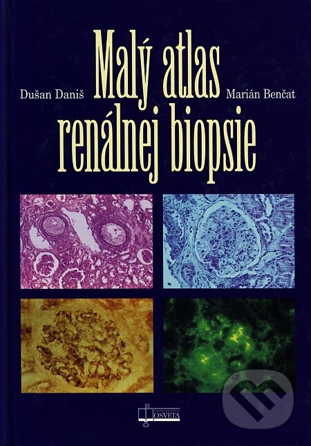 Levně Malý atlas renálnej biopsie - Dušan Daniš, Marián Benčat - kniha z kategorie Nefrológia a gastroenterológia