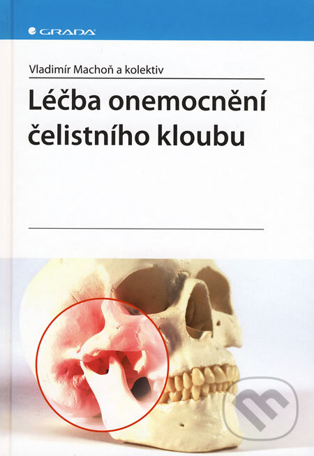 Kniha: Léčba onemocnění čelistního kloubu (Vladimír Machoň a kolektív). Grada, 2008