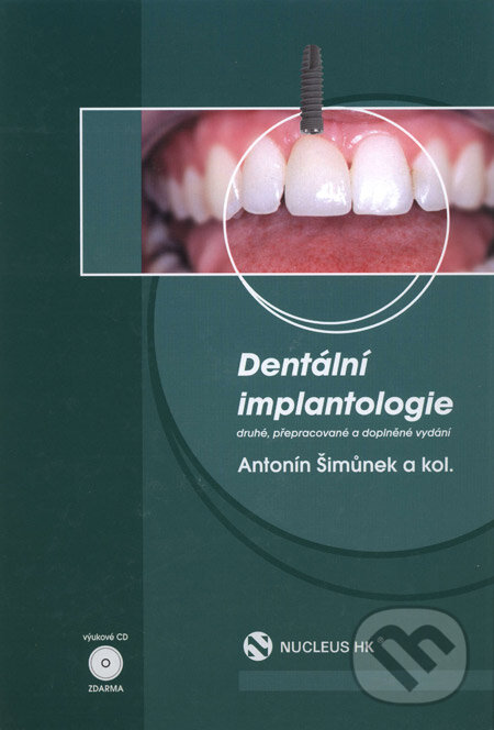 Dentální implantologie - Antotnín Šimůnek a kolektív, Nucleus HK, 2008