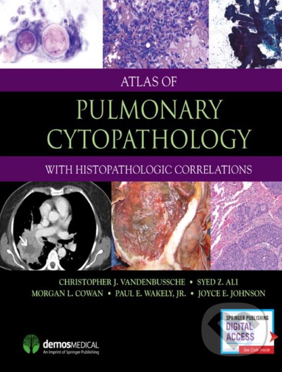 Levně Atlas of Pulmonary Cytopathology (With Histopathologic Correlations) - kniha z kategorie Medicína