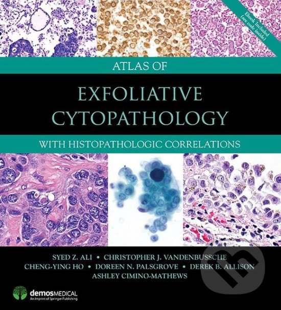 Levně Atlas of Exfoliative Cytopathology (With Histopathologic Correlations) - kniha z kategorie Medicína