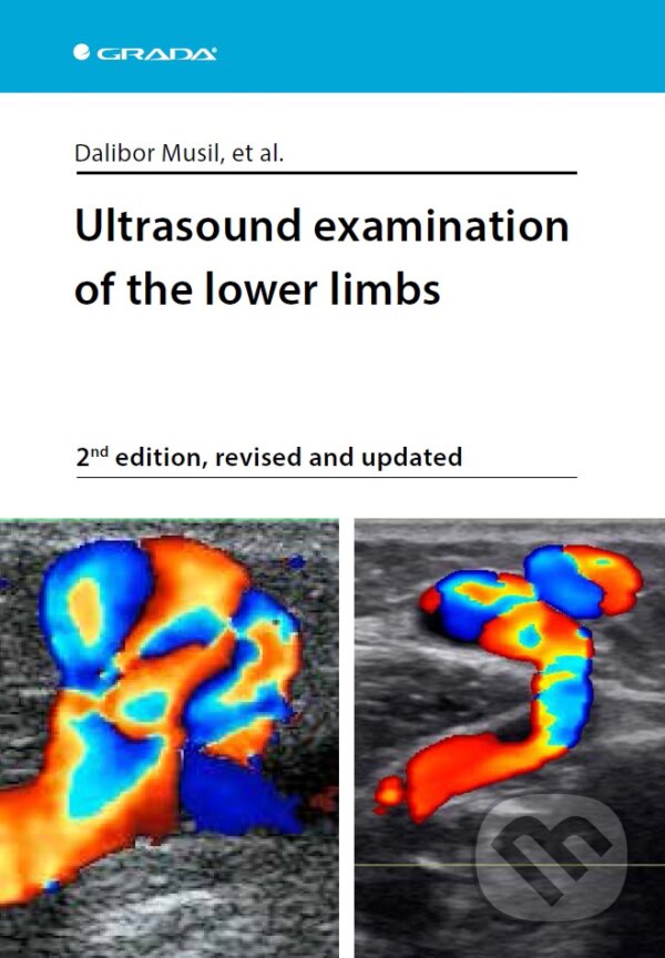 Ultrasound examination of the lower limbs - Musil Dalibor a kolektiv, Grada, 2019