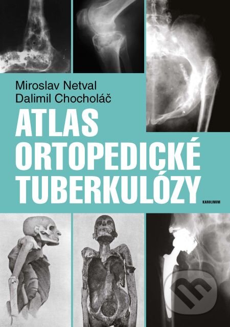 E-kniha: Atlas ortopedické tuberkulózy (Dalimil Chocholáč a Miroslav Netval). Karolinum, 2014