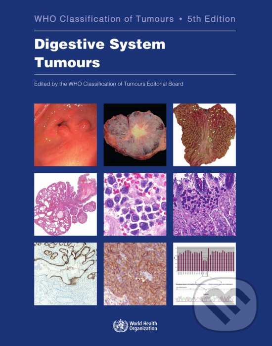 Levně Who Classification of Tumours: Digestive System Tumours - kniha z kategorie Onkológia