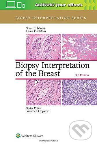 Biopsy Interpretation of the Breast, Lippincott Williams & Wilkins, 2017