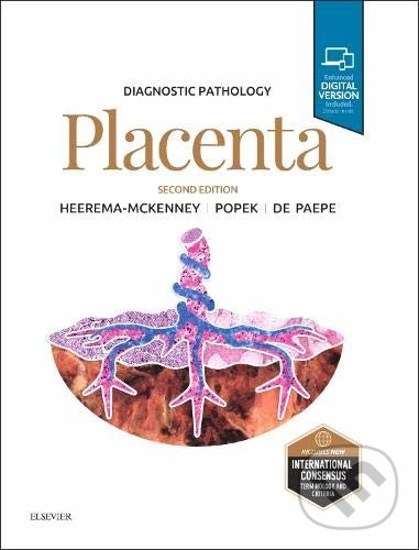 Levně Diagnostic Pathology: Placenta - Amy Heerema-Mckenney, Edwina J. Popek, Monique De Paepe - kniha z kategorie Pôrodníctvo