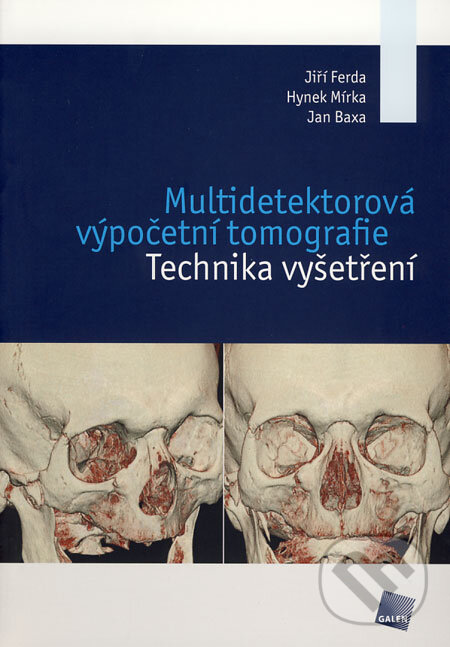Kniha: Multidetektorová výpočetní tomografie (Hynek Mírka, Jan Baxa a Jiří Ferda). Galén, 2009