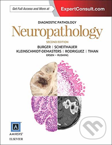 Levně Diagnostic Pathology: Neuropathology (Second Edition) - kniha z kategorie Medicína