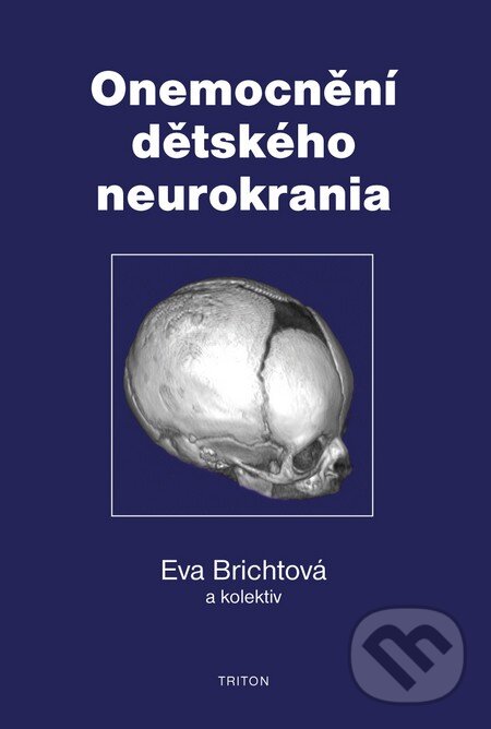 Kniha: Onemocnění dětského neurokrania (Eva Brichtová a kolektív). Triton, 2009