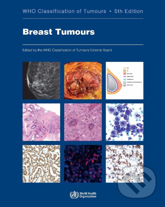 Levně Who Classification of Tumours: Breast Tumours (Fifth Edition) - kniha z kategorie Onkológia