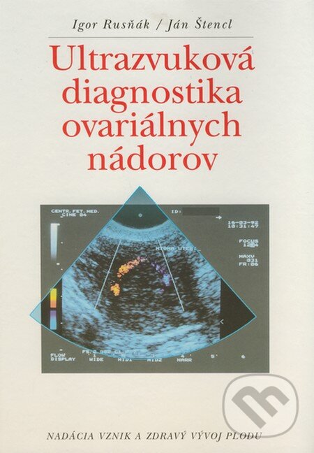Levně Ultrazvuková diagnostika ovariálnych nádorov - Igor Rusňák, Ján Štencl - kniha z kategorie Onkológia