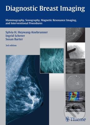 Levně Diagnostic Breast Imaging (Mammography, Sonography, MRI and Interventional Procedures) - kniha z kategorie Medicína