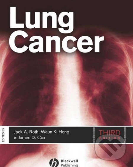 Levně Lung Cancer - Jack A. Roth, James D. Cox, Waun Ki Hong - kniha z kategorie Onkológia