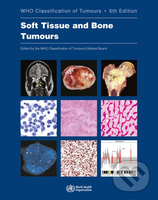 Levně Soft Tissue and Bone Tumours (Who Classification of Tumours (5th Edition, Volume 3)) - kniha z kategorie Medicína