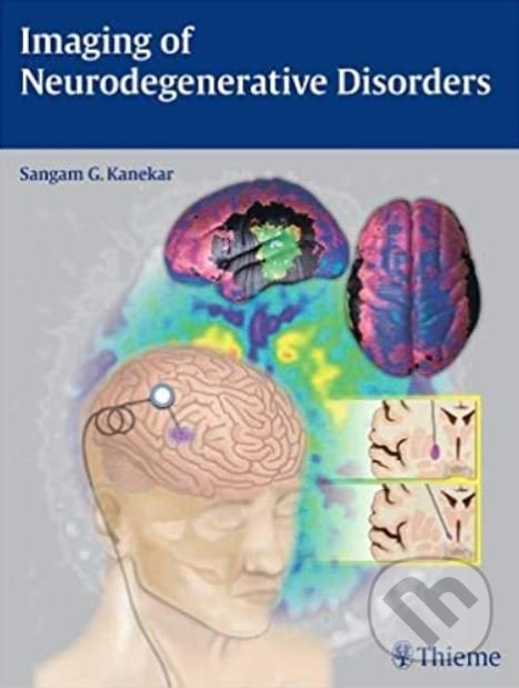 Levně Imaging of Neurodegenerative Disorders - Sangam G. Kanekar - kniha z kategorie Medicína