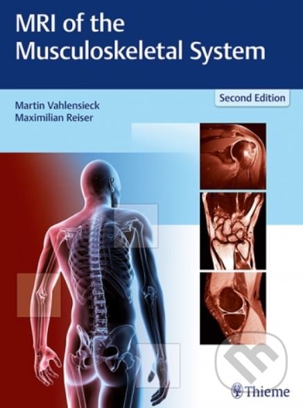 Levně MRI of the Musculoskeletal System - Martin Vahlensieck, Maximilian Reiser - kniha z kategorie Medicína