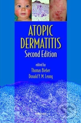 Levně Atopic Dermatitis (Second Edition) - Thomas Bieber, Donald Y.M. Leung - kniha z kategorie Odborné a náučné