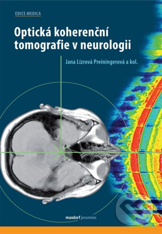 Levně Optická koherenční tomografie v neurologii - Jana Preiningerová Lízrová - kniha z kategorie Neurológia