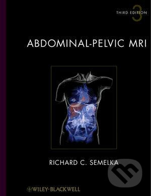 Kniha: Abdominal-Pelvic MRI (Richard C. Semelka). Wiley-Blackwell, 2010