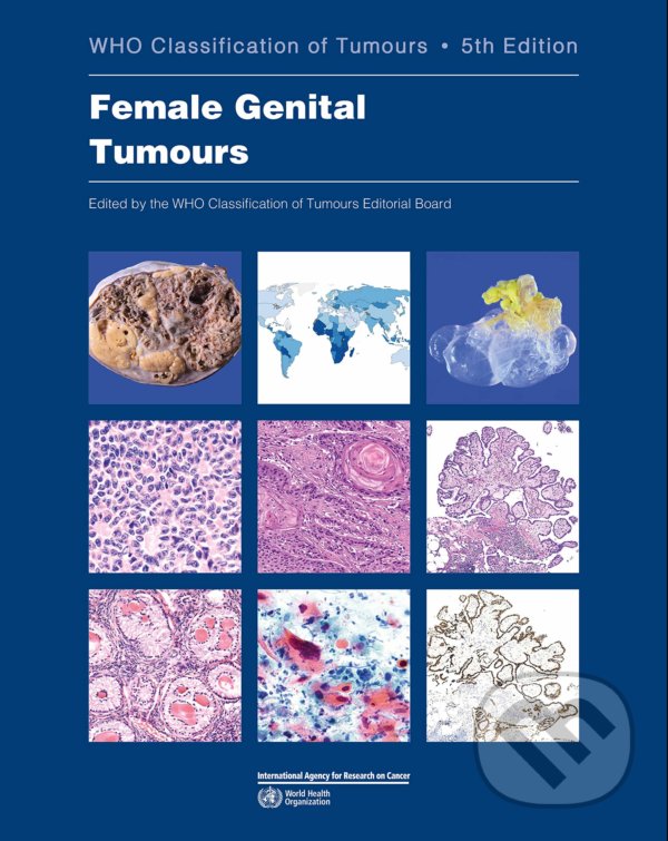 Kniha: Female Genital Tumours (World Health Organization). World Health Organization, 2020