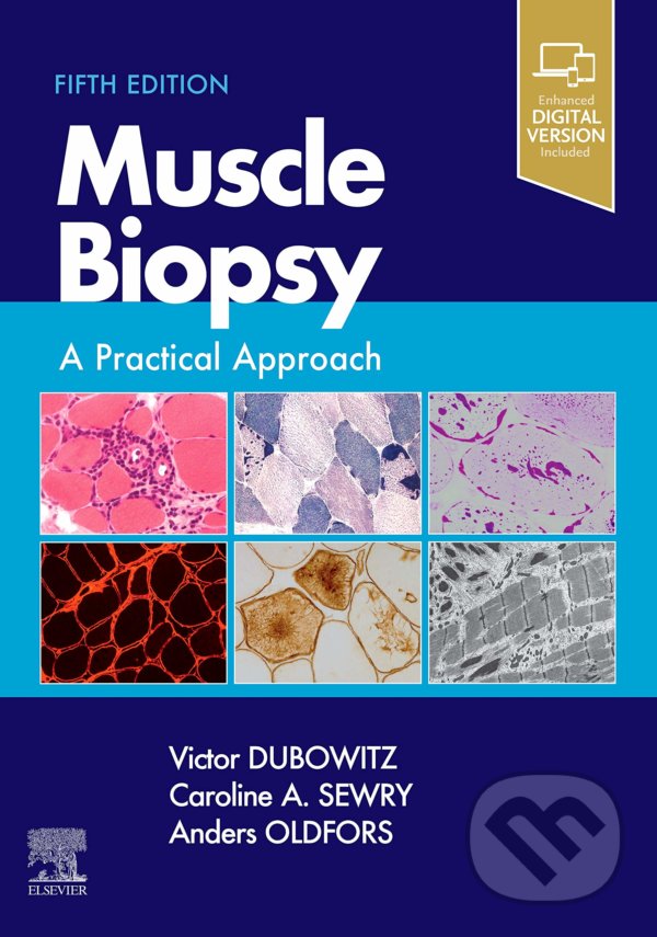 Levně Muscle Biopsy (A Practical Approach) - Victor Dubowitz, Caroline A. Sewry, Anders Oldfors - kniha z kategorie Medicína