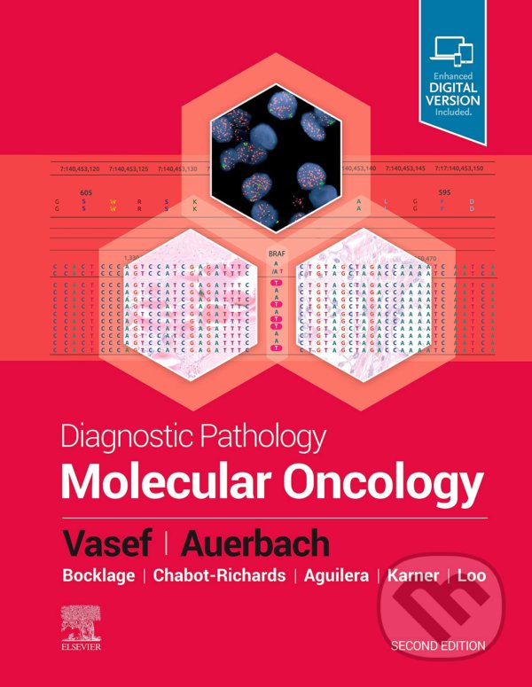 Levně Diagnostic Pathology: Soft Tissue Tumors - Matthew R. Lindberg - kniha z kategorie Medicína