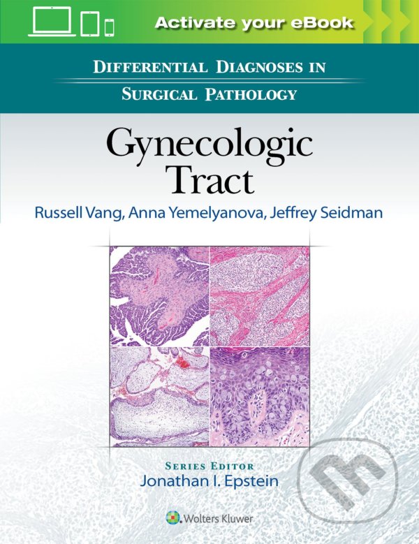 Levně Differential Diagnoses in Surgical Pathology: Gynecologic Tract - kniha z kategorie Medicína