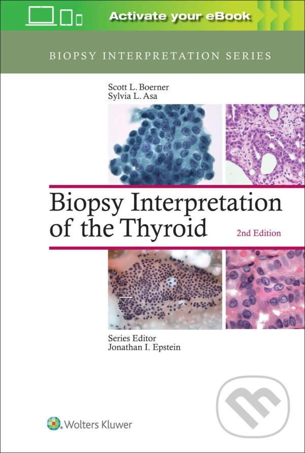 Kniha: Biopsy Interpretation of the Thyroid (Scott L. Boerner a Sylvia L. Asa)