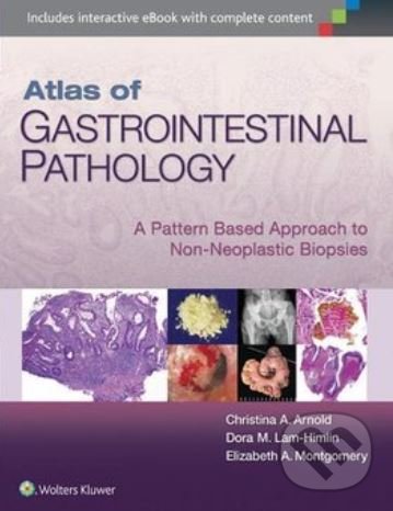 Levně Atlas of Gastrointestinal Pathology (A Pattern Based Approach to Non-Neoplastic) - kniha z kategorie Medicína